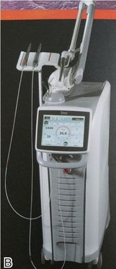 口腔醫學中的激光醫療設備 原理、應用與前景